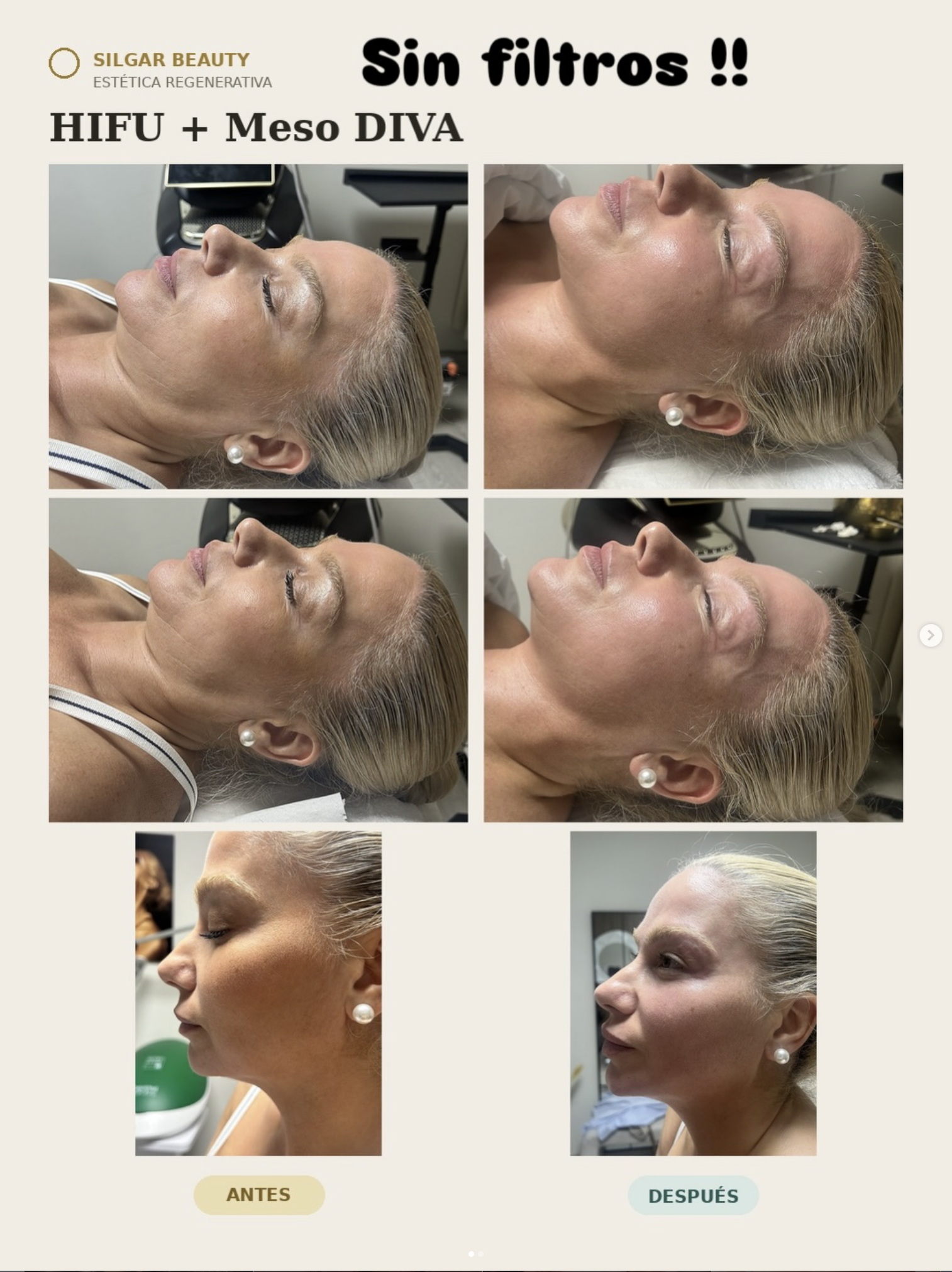 Silgar Beauty Instagram