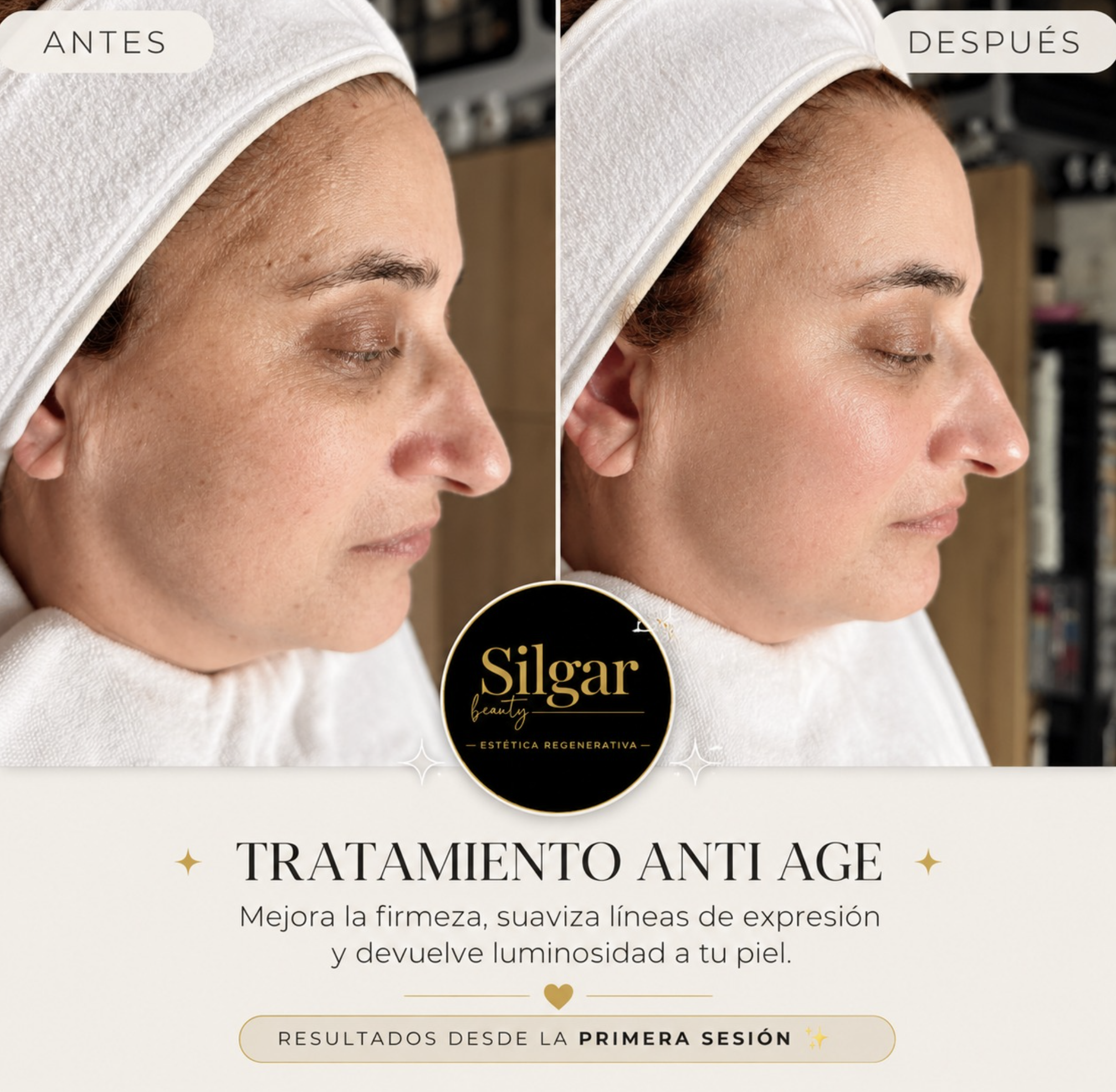Silgar Beauty Instagram